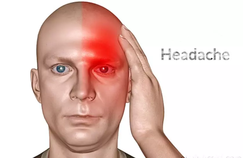 Obat Sakit Kepala Sebelah Kiri